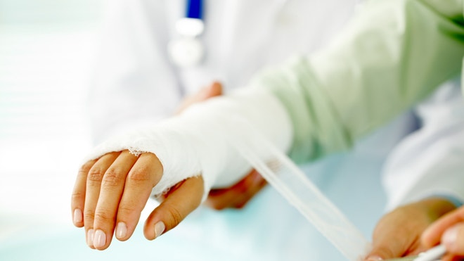 Broken bone.jpg